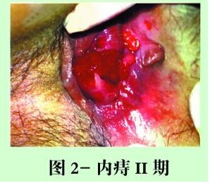 內置的癥狀和體征